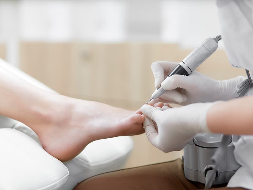 foto voeten site care oncologie